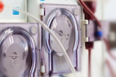 View of peristaltic pump of dialysis machine